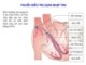 Bài giảng Thuốc điều trị loạn nhịp tim (46tr)